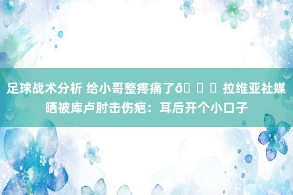 足球战术分析 给小哥整疼痛了😅拉维亚社媒晒被库卢肘击伤疤：耳后开个小口子